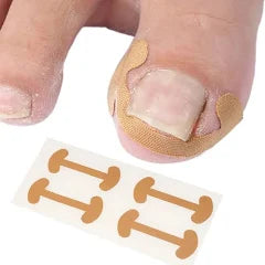 NailCare™ - Sticker para uñas encarnadas
